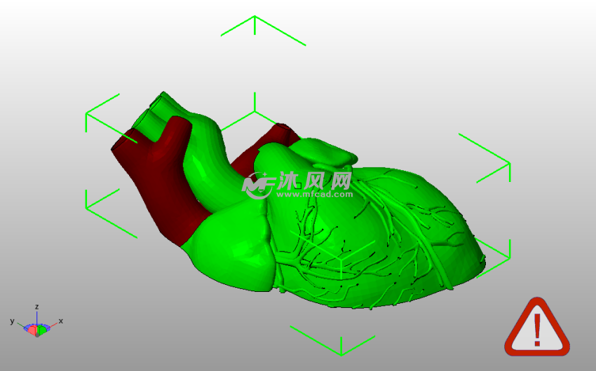 解剖心脏左侧斜视图