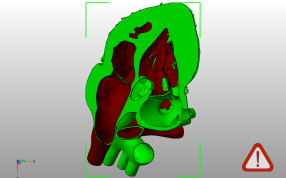 解剖心脏左侧后视图