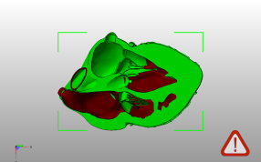 解剖心脏右侧后视图