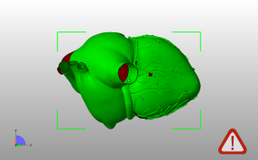 解剖心脏右侧主视图