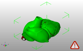解剖心脏右侧斜视图