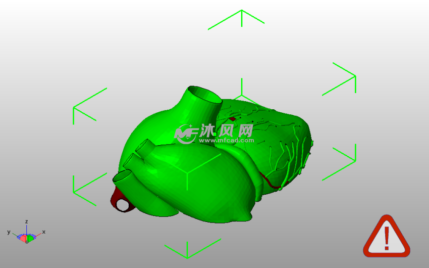 解剖心脏右侧斜视图