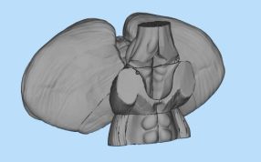 肝脏3D打印模型