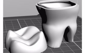 牙模盒子模型模型图