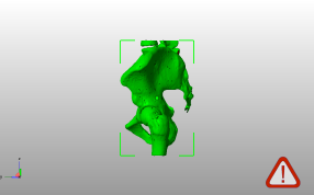 男性骨盆模型侧视图