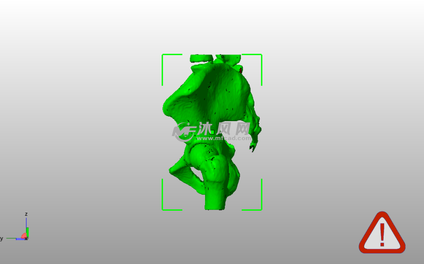 男性骨盆模型侧视图