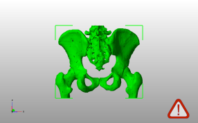 男性骨盆模型主视图