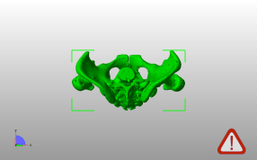 男性骨盆模型俯视图