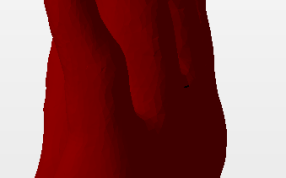 手的假肢模型右视图