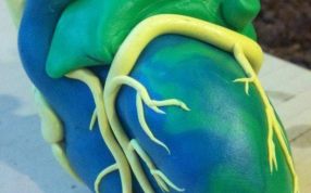 心脏的解剖图实体图