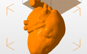 心脏的解剖等轴测试图