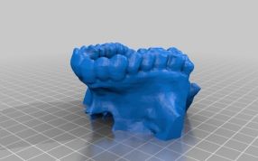 人体的上颌骨模型