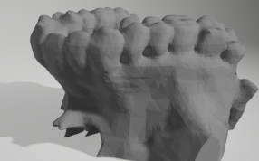 人体的上颌骨轴测图