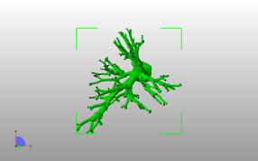 肺动脉模型俯视图