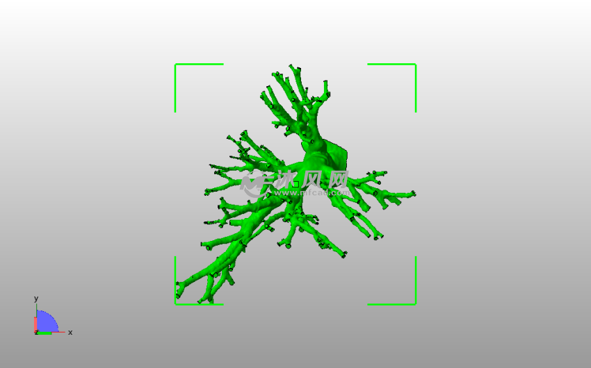 肺动脉模型俯视图