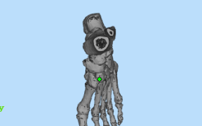 人体脚骨俯视图